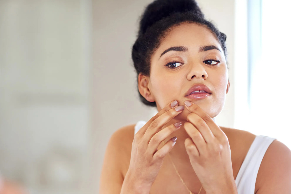 Is Stress Causing Your Acne Or Acne Causing You Stress