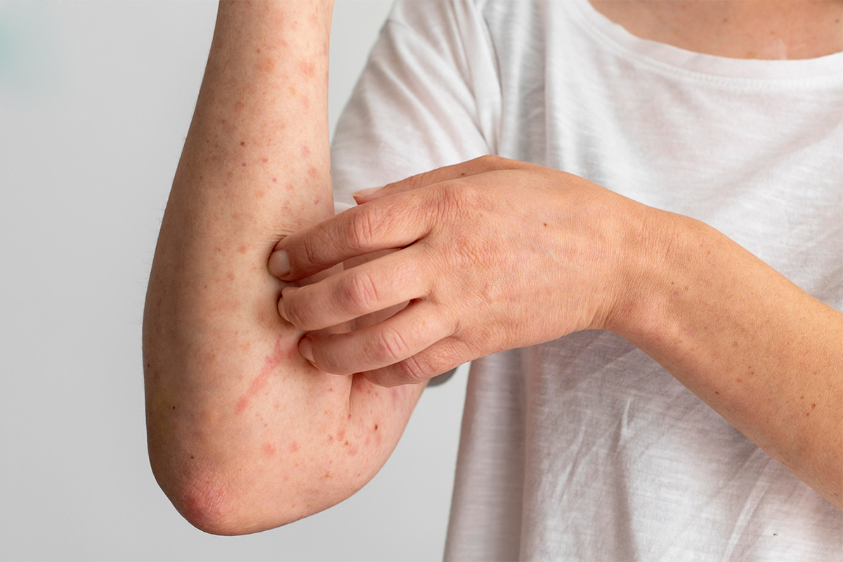Why skin diseases are chronic and difficult to treat?